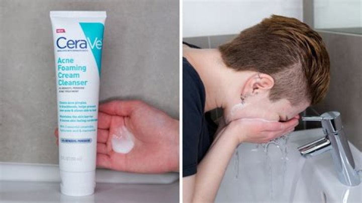 Acne cleanser - How To Discuss