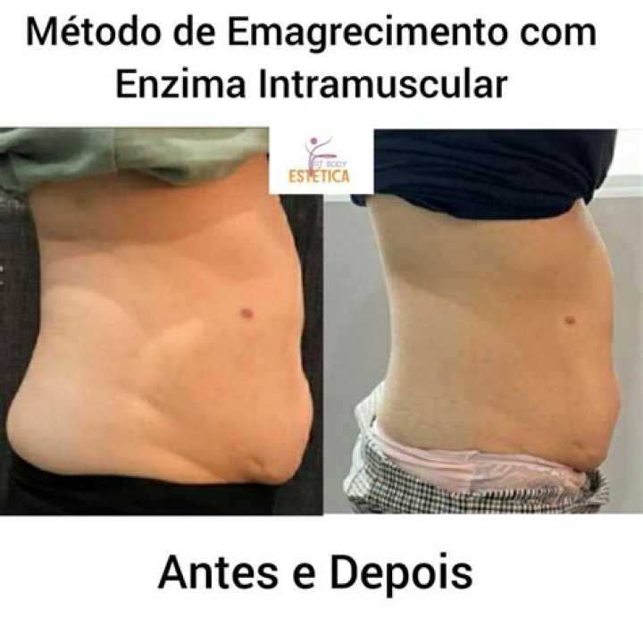 AplicaÃ§Ã£o De Enzimas Emagrece Quantos Quilos