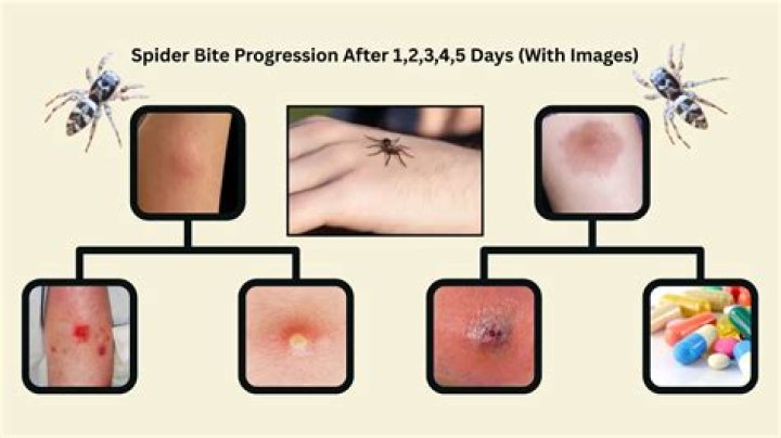 Aspect Of The Spider - How To Discuss