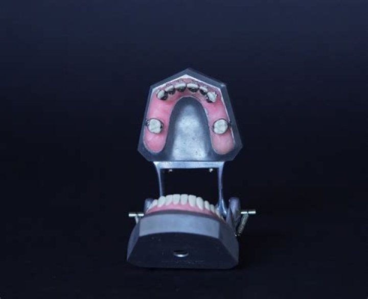 Braces In The 1940s - How To Discuss