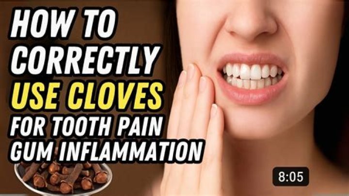 Clove for tooth pain - How To Discuss