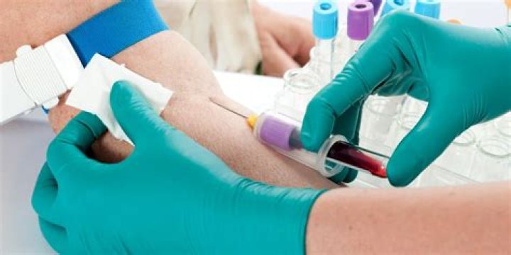 Cvc Bloodwork - How To Discuss