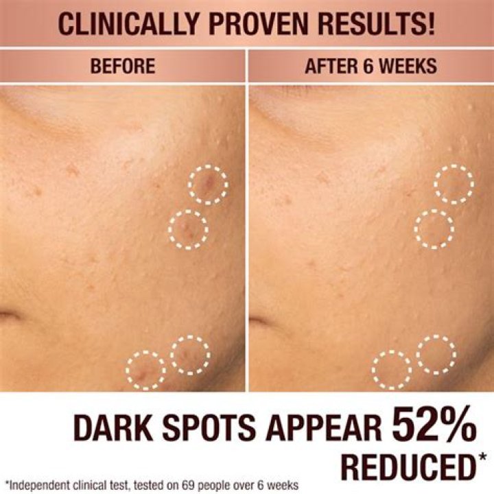 Dark spot serum - How To Discuss