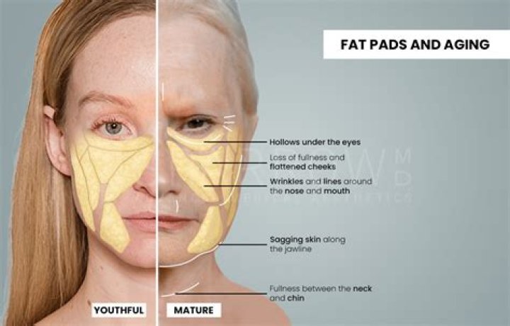 Face pads - How To Discuss