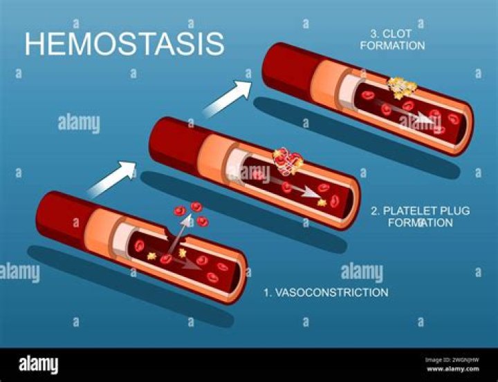 Hemostasis - How To Discuss