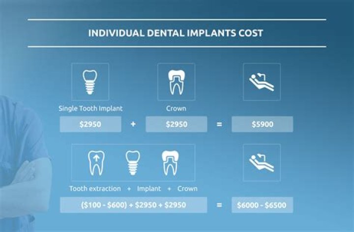How much are dental implants
