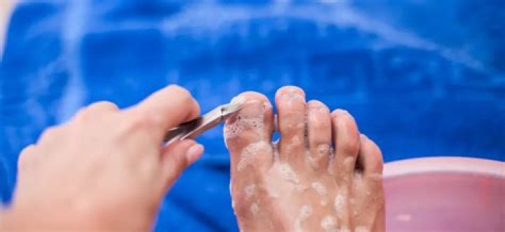 Ingrown toenail warm soak - How To Discuss