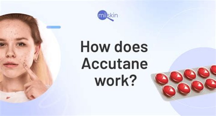 Is accutane worth it - How To Discuss