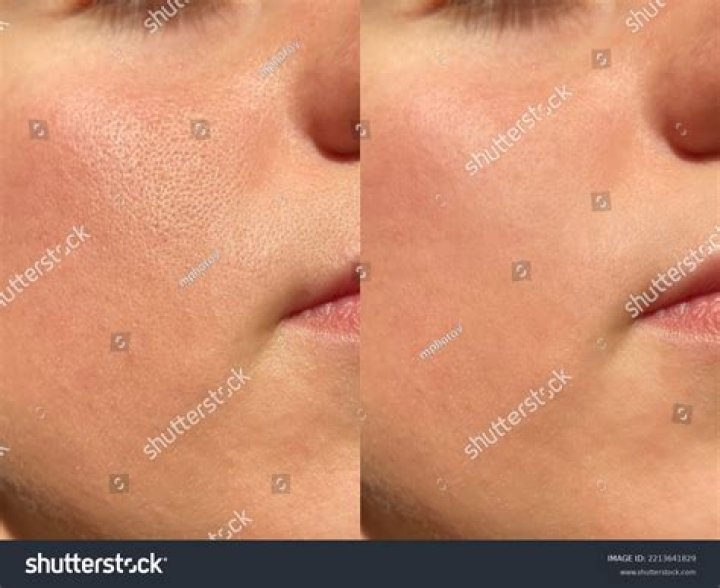 Large pores vs small pores