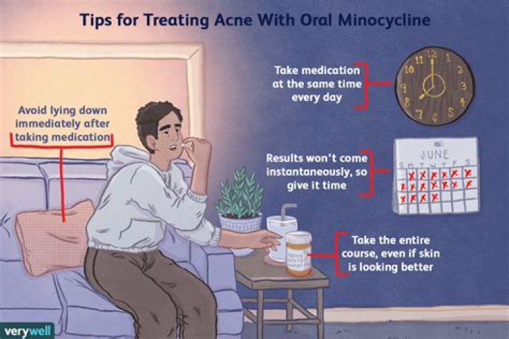 Minocycline for acne - How To Discuss
