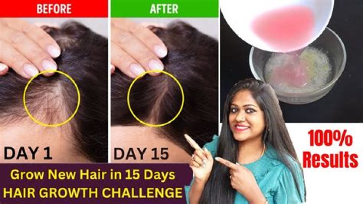 Miracle Grow For Your Hair