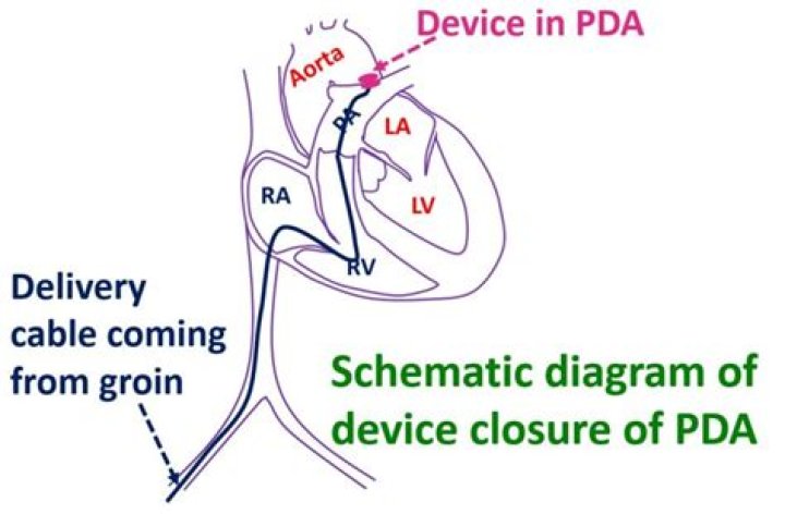 Pda device - How To Discuss