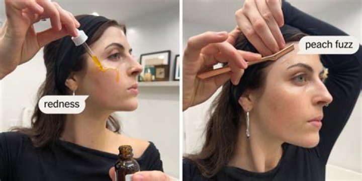 Peach fuzz razor - How To Discuss