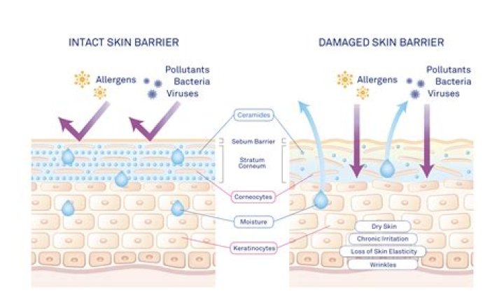 Skin barrier - How To Discuss