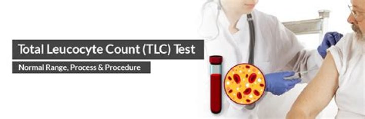 Total count test - How To Discuss