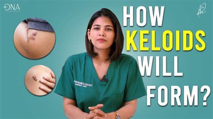 What is a keloid - How To Discuss