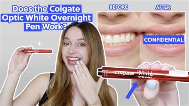 Whitening pen - How To Discuss